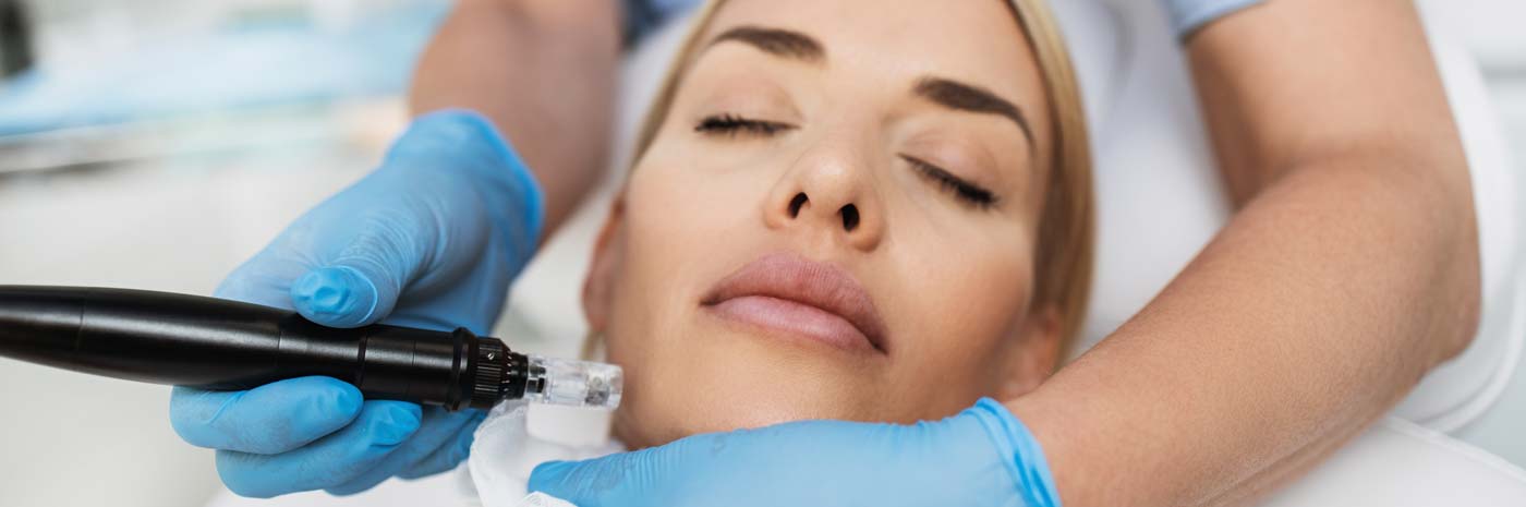Anti-Aging Behandlung mit MicroNeedling