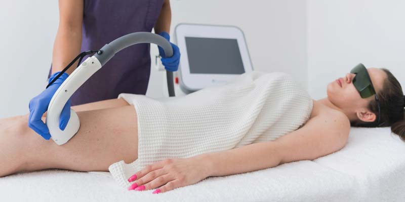 Laser-Haarentfernung Beine