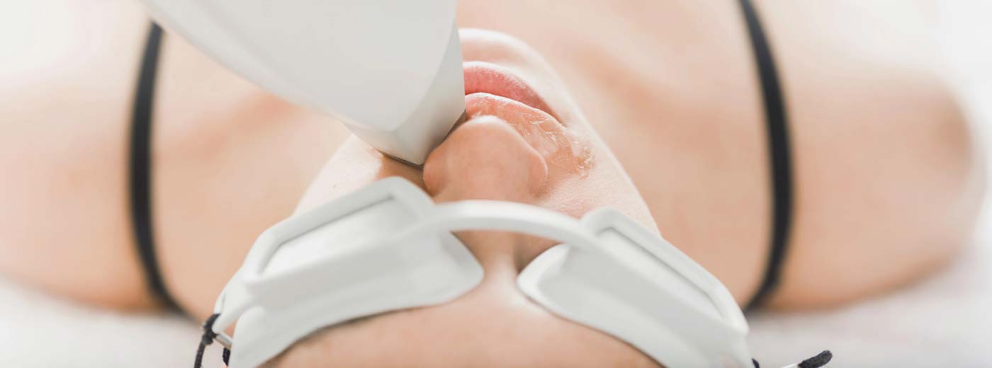 Laser-Haarentfernung Oberlippe