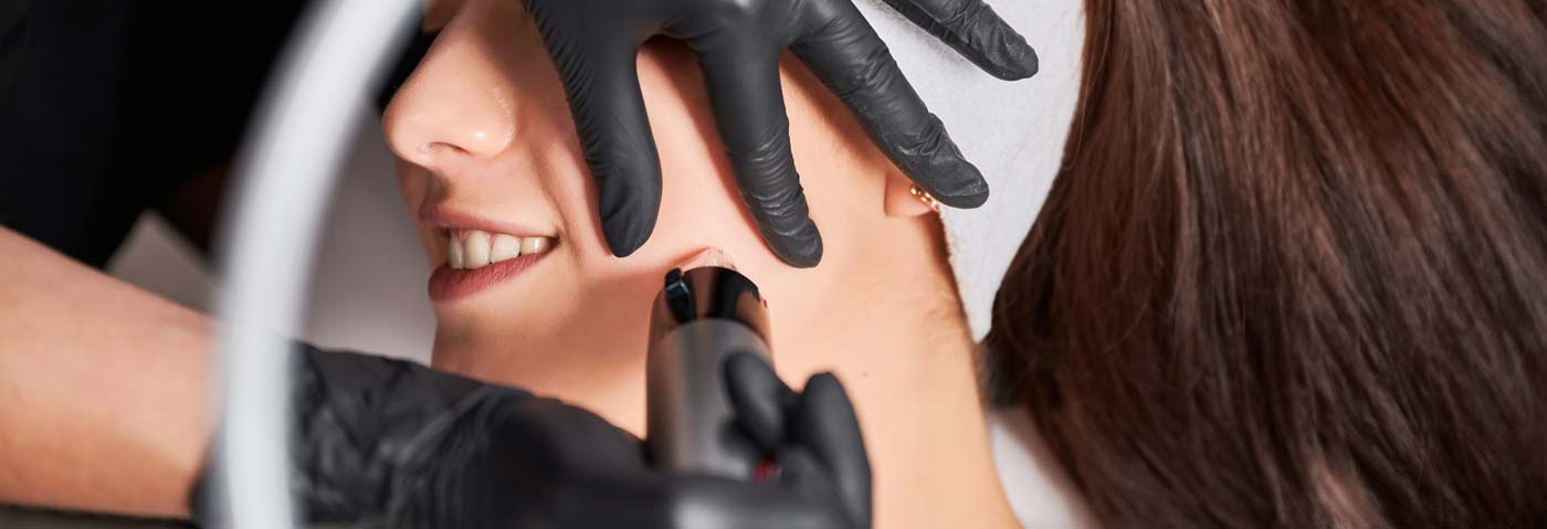 Medical Microneedling in Zürich