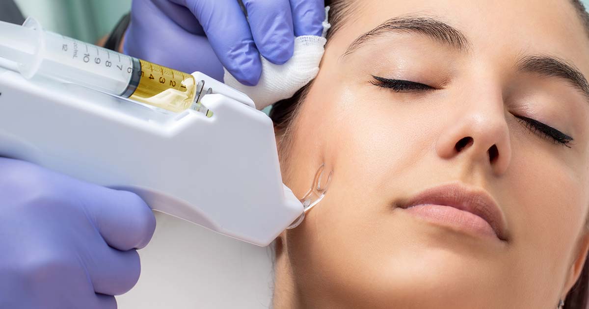 Mesotherapie: Facelift ohne OP - Die Alternative zur Schönheitschirurgie